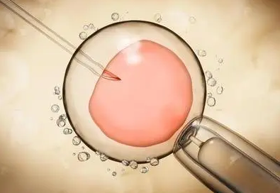 青碧生殖医学中心